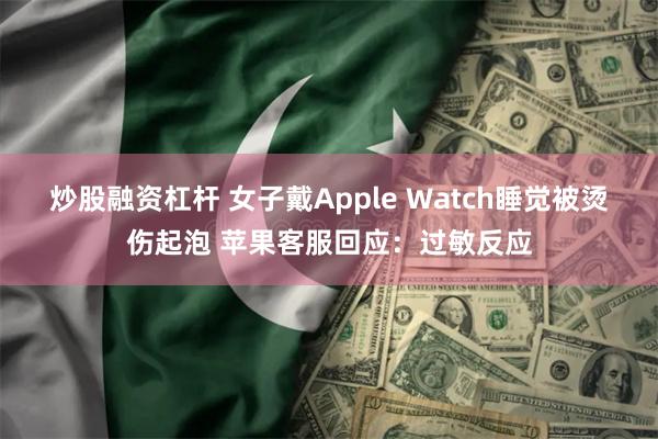 炒股融资杠杆 女子戴Apple Watch睡觉被烫伤起泡 苹果客服回应：过敏反应